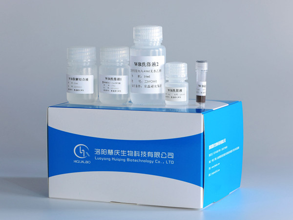 核酸提取試劑在動物檢疫中的應(yīng)用優(yōu)勢和注意事項