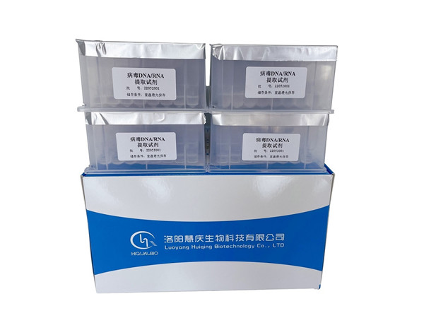 磁珠法核酸提取試劑盒的選購要求有哪些？