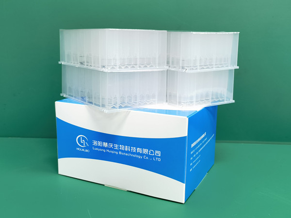 體外診斷行業(yè)的發(fā)展趨勢是什么？且看核酸提取試劑廠家解讀